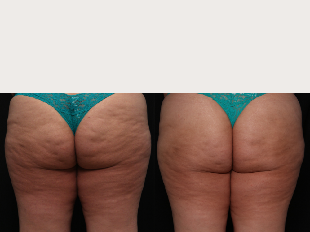 Premier Dermatology