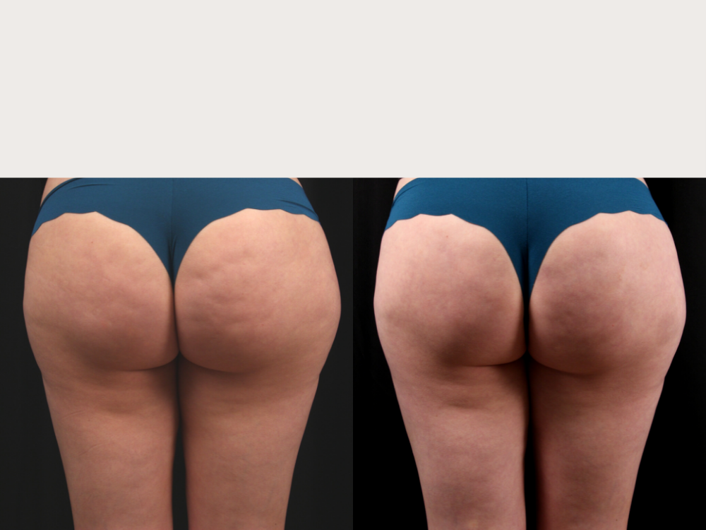 Premier Dermatology