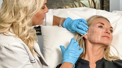 SKINVIVE by Juvederm