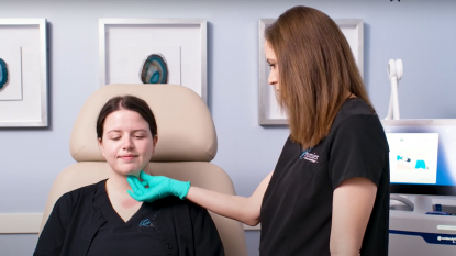 CoolSculpting Elite for Chin