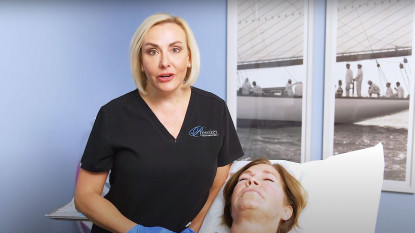 Morpheus8 Eye Rejuvenation