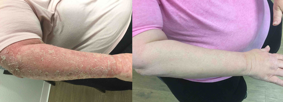 Premier Dermatology