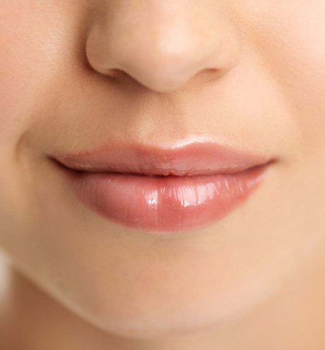 Dermal Fillers Information
