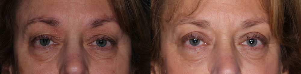 Premier Dermatology