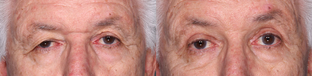 Premier Dermatology