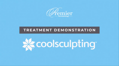 CoolSculpting. Freeze Away Fat.