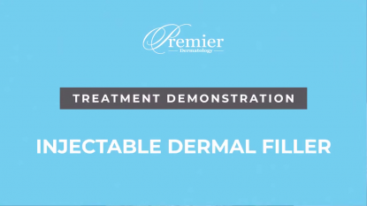 Dermal Fillers for Volume Loss