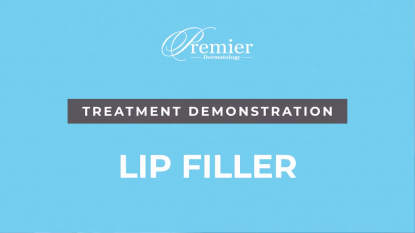 Lip Filler