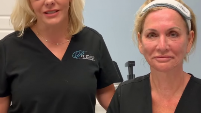 Morpheus8 & AccuTite by InMode Aesthetics